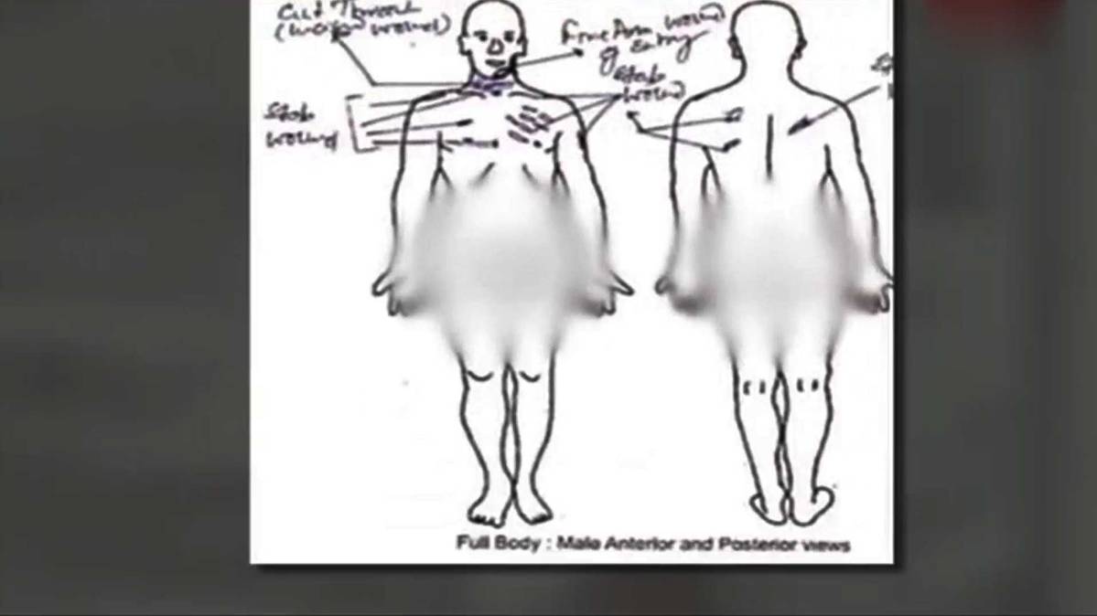 कमलेश तिवारी की पोस्टमॉर्टम रिपोर्ट
