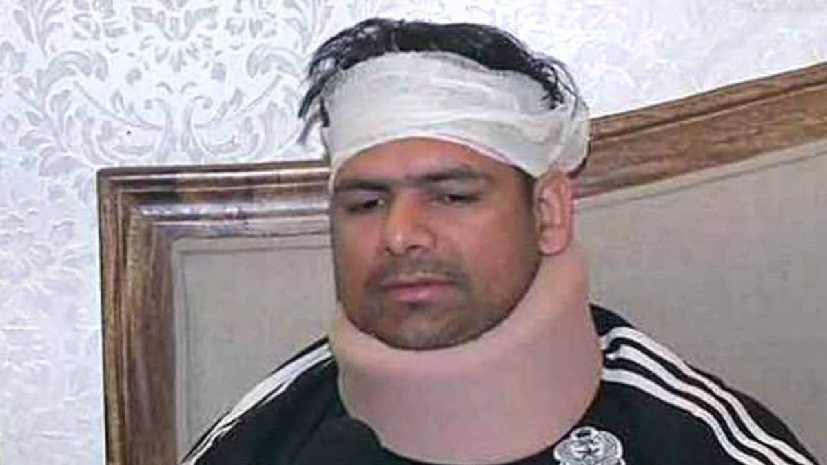 हिंसा में घायल एसीपी अनुज कुमार ने बताई हिंसा की पूरी कहानी