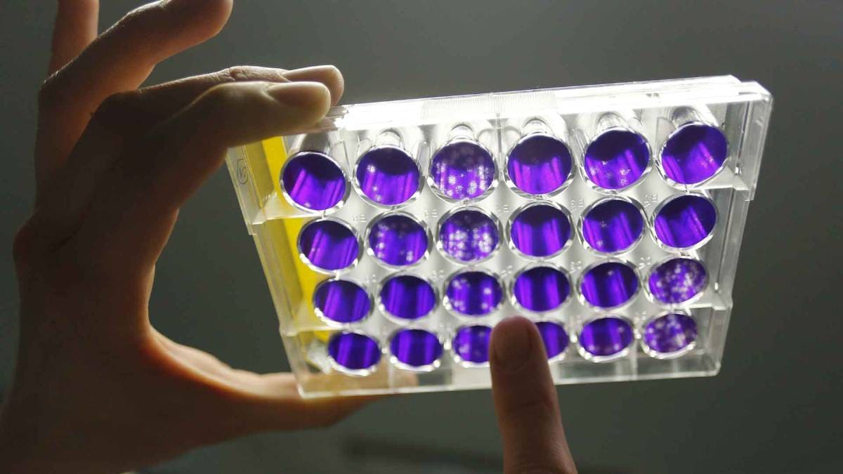 प्रतीकात्मक तस्वीर