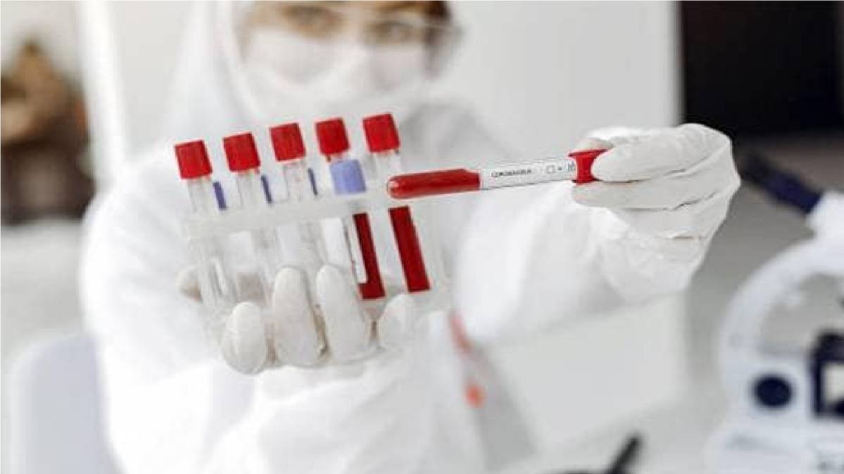 कोरोना लैब टेस्ट