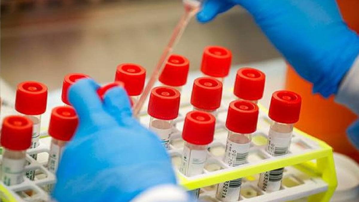 चीन से आ रही हैं टेस्टिंग किट्स