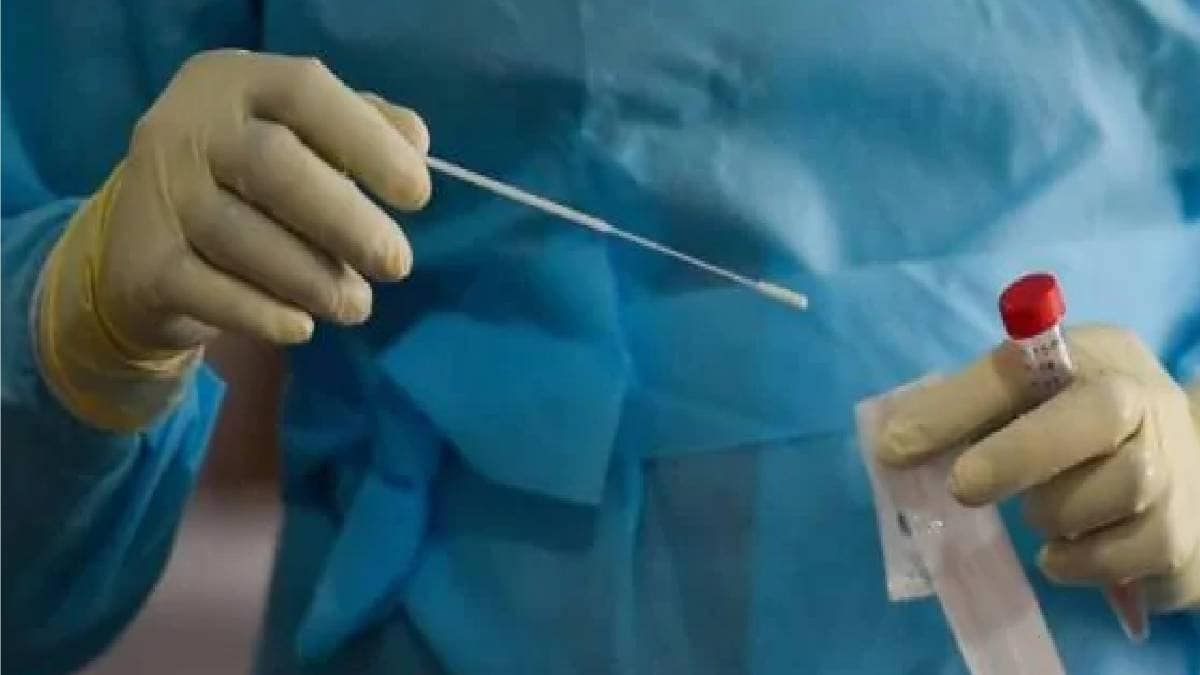 रैपिड टेस्टिंग किट