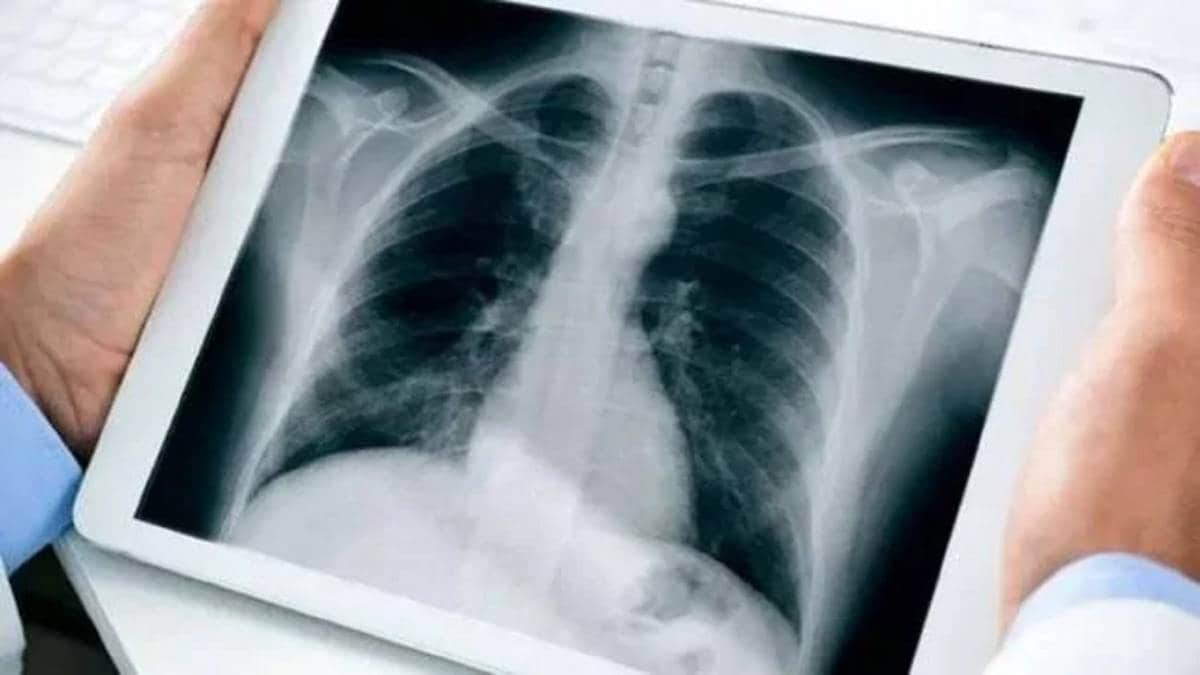 x ray