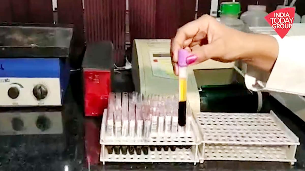 Corona antibody testing starts in UP