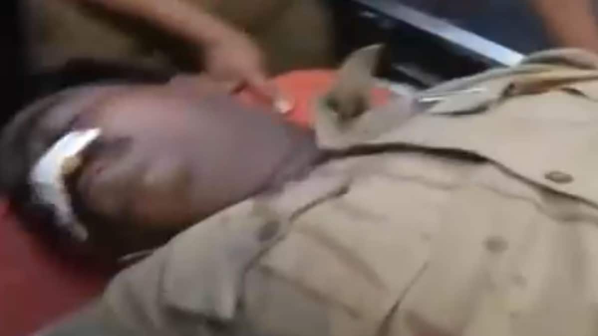 Injured cops in Kanpur Vikas Dubey encounter (File- Videograb Aaj Tak)
