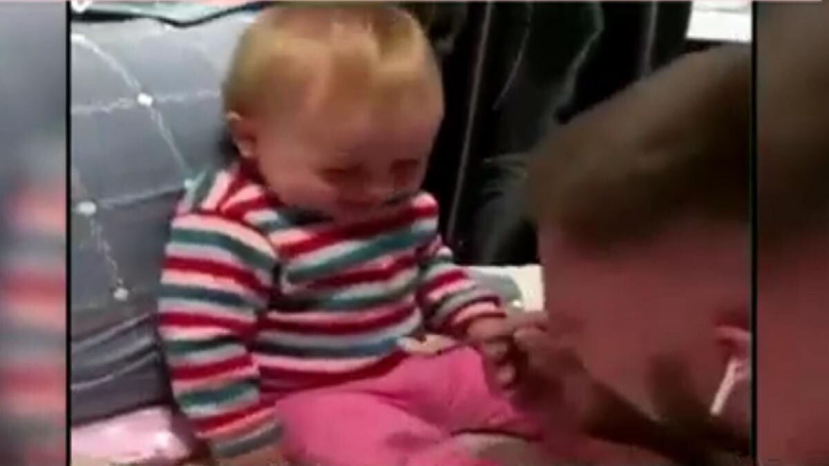 serebral palsi bebek video