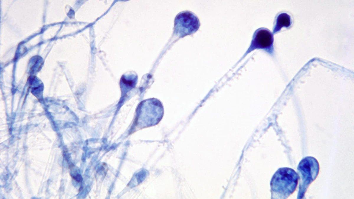 black fungus epidemic