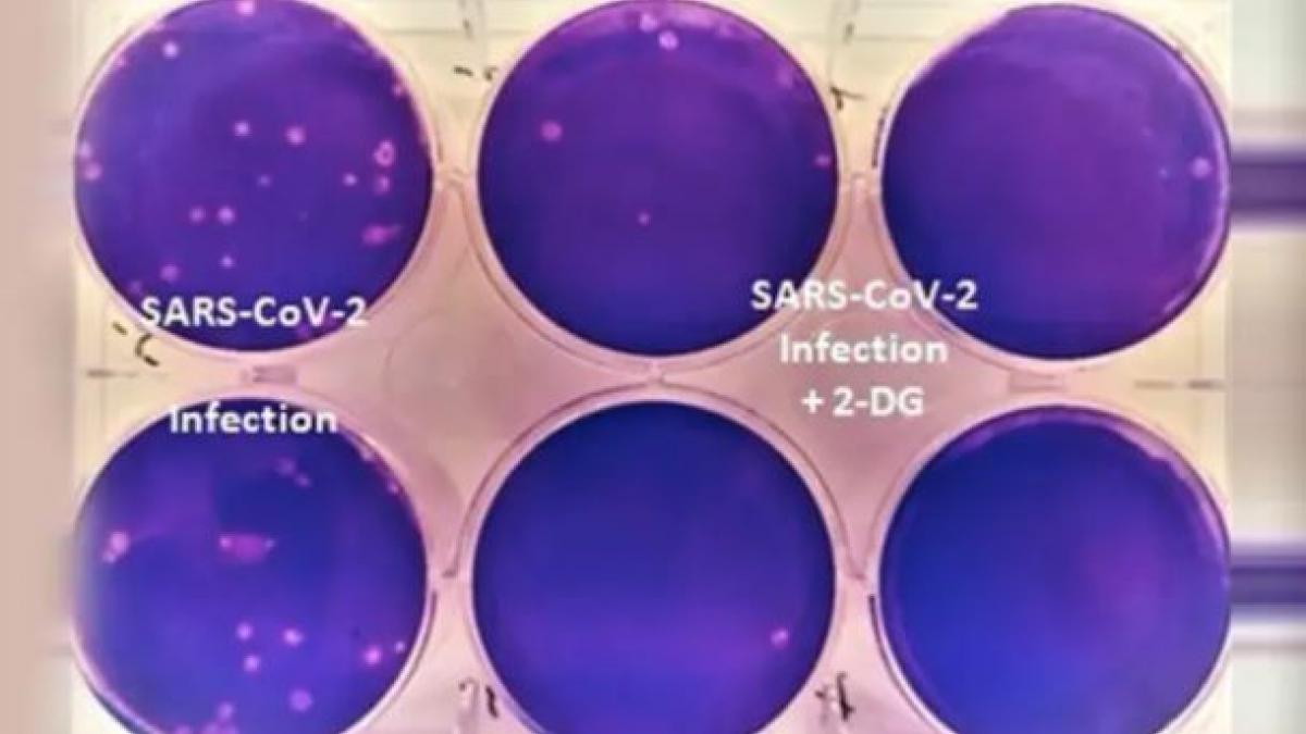 DRDO's anti-Covid drug 2-DG 