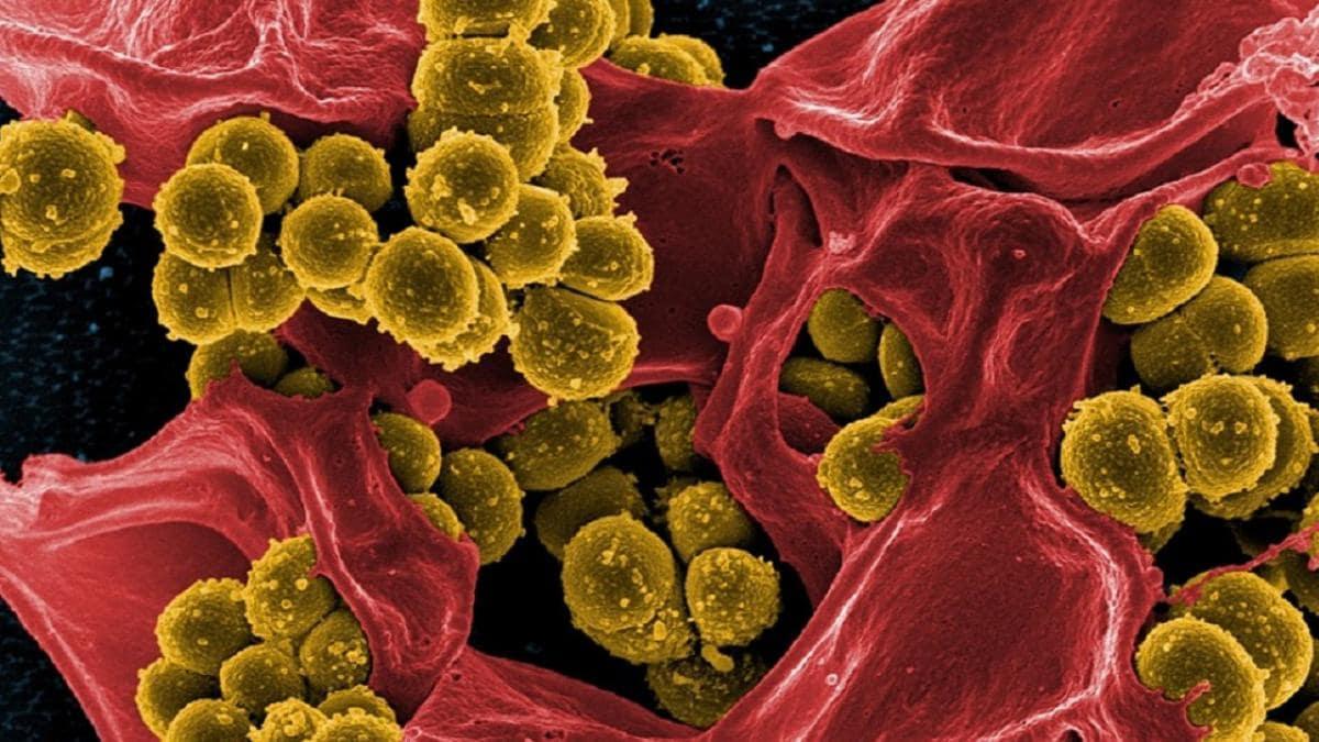 How to identify signs and symptoms of black fungus?