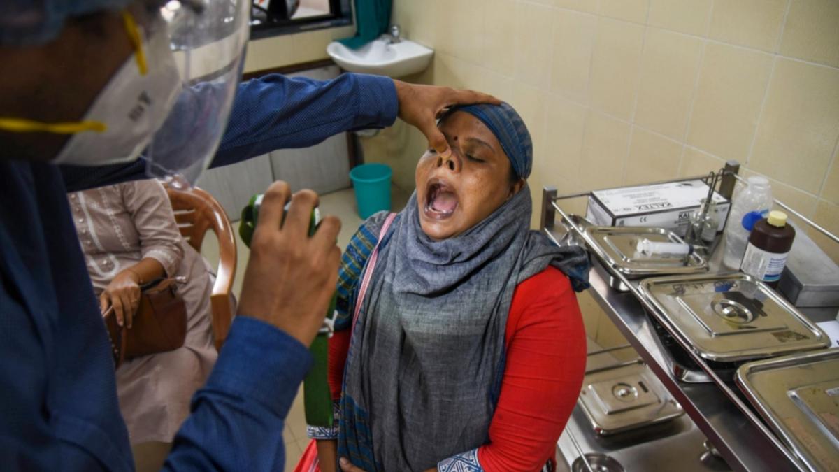 Black Fungus, Indore (File-PTI)