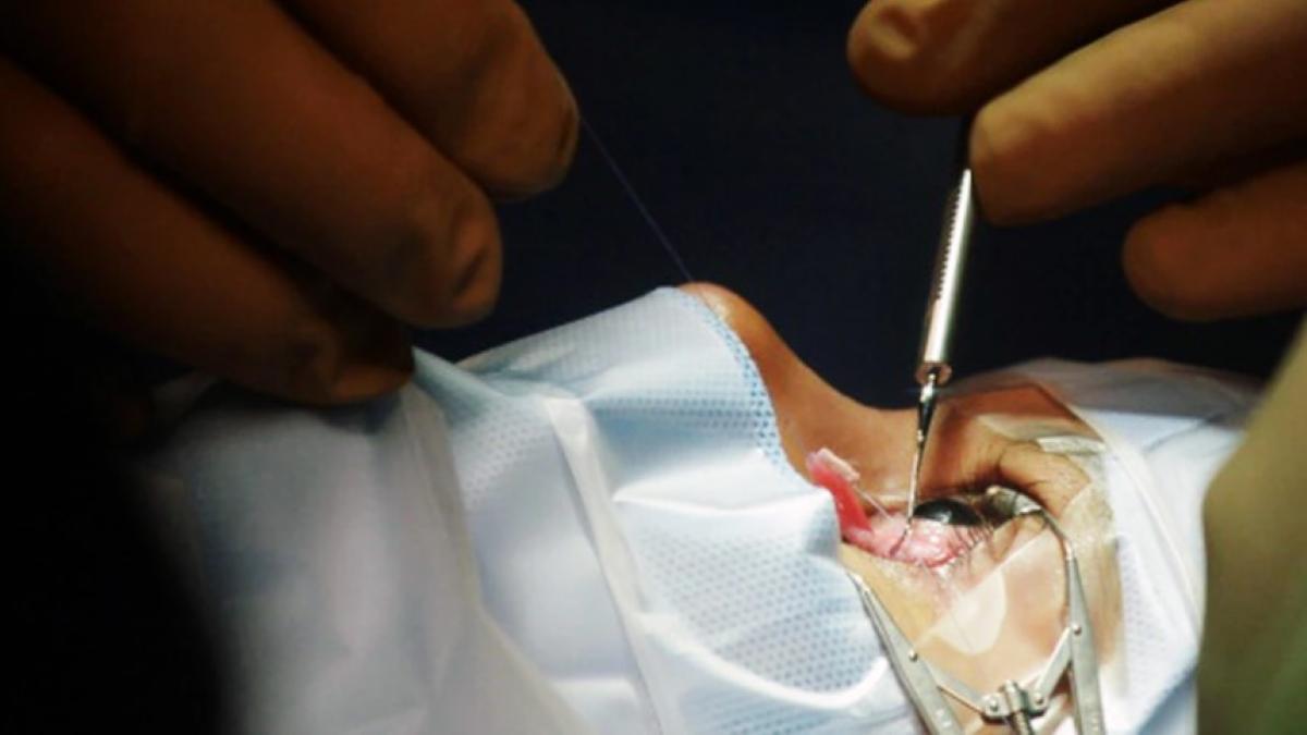 Eyes of three children infected with black fungus had to be removed in Mumbai