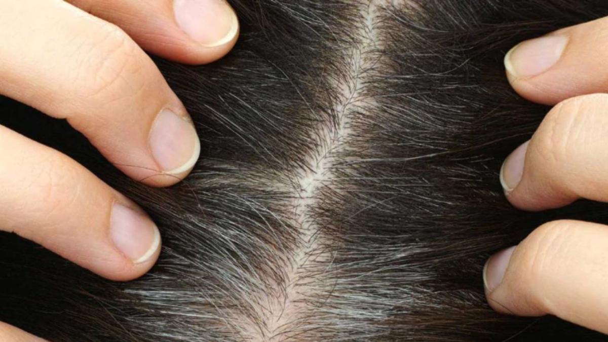 Hair problem, Astro Tips 