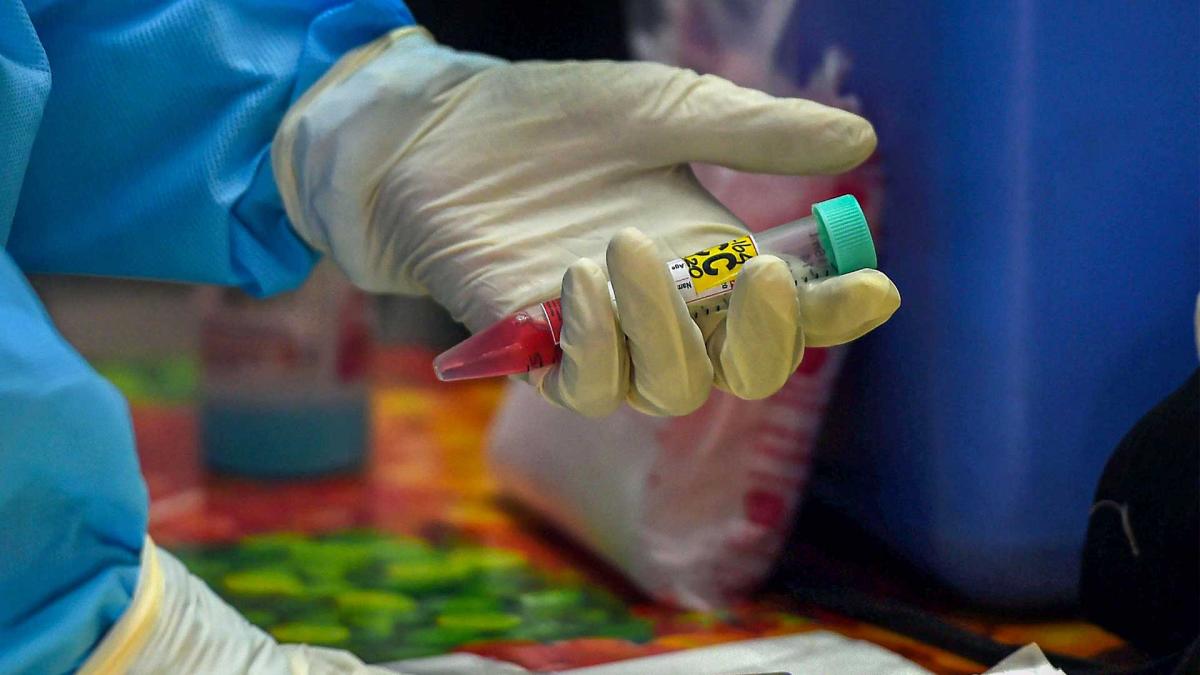 Zika Virus case (Rep. Image)