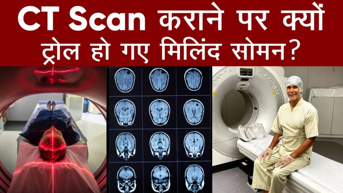 Milind Soman CT Scan