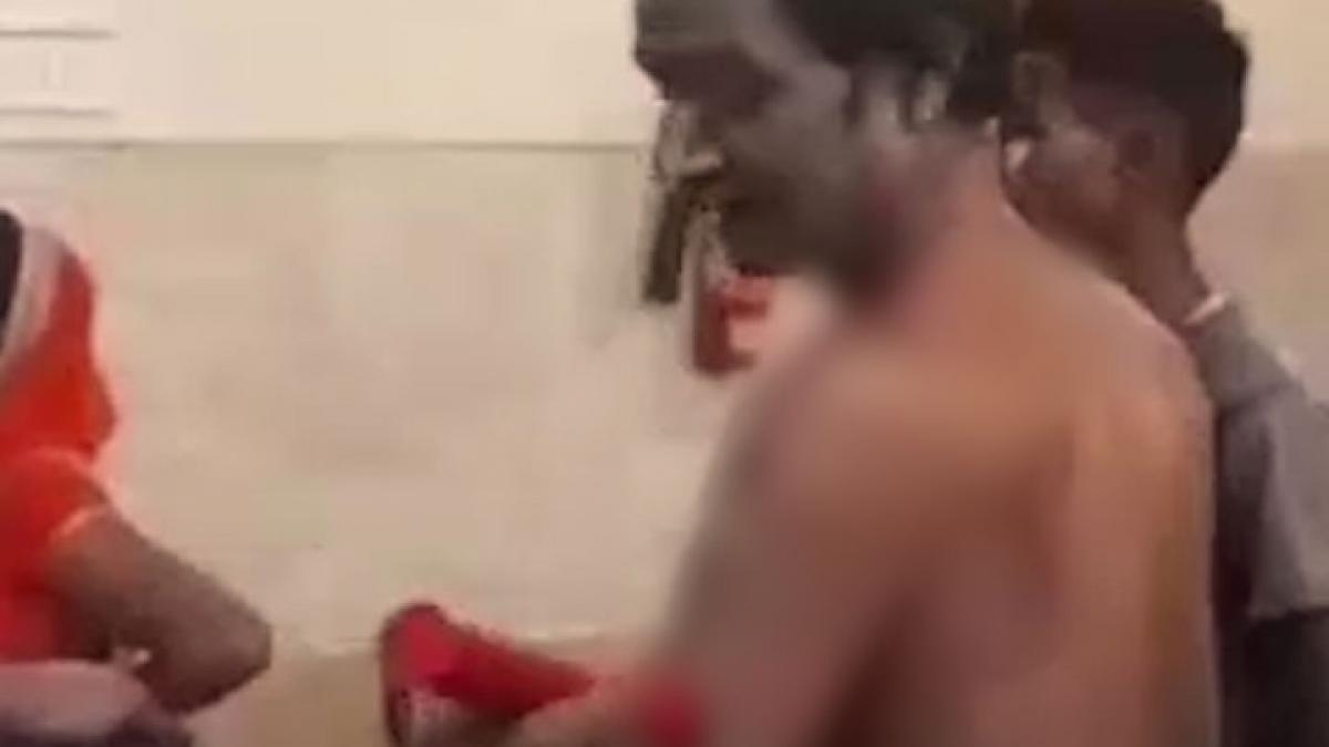 Acid attack in bokaro