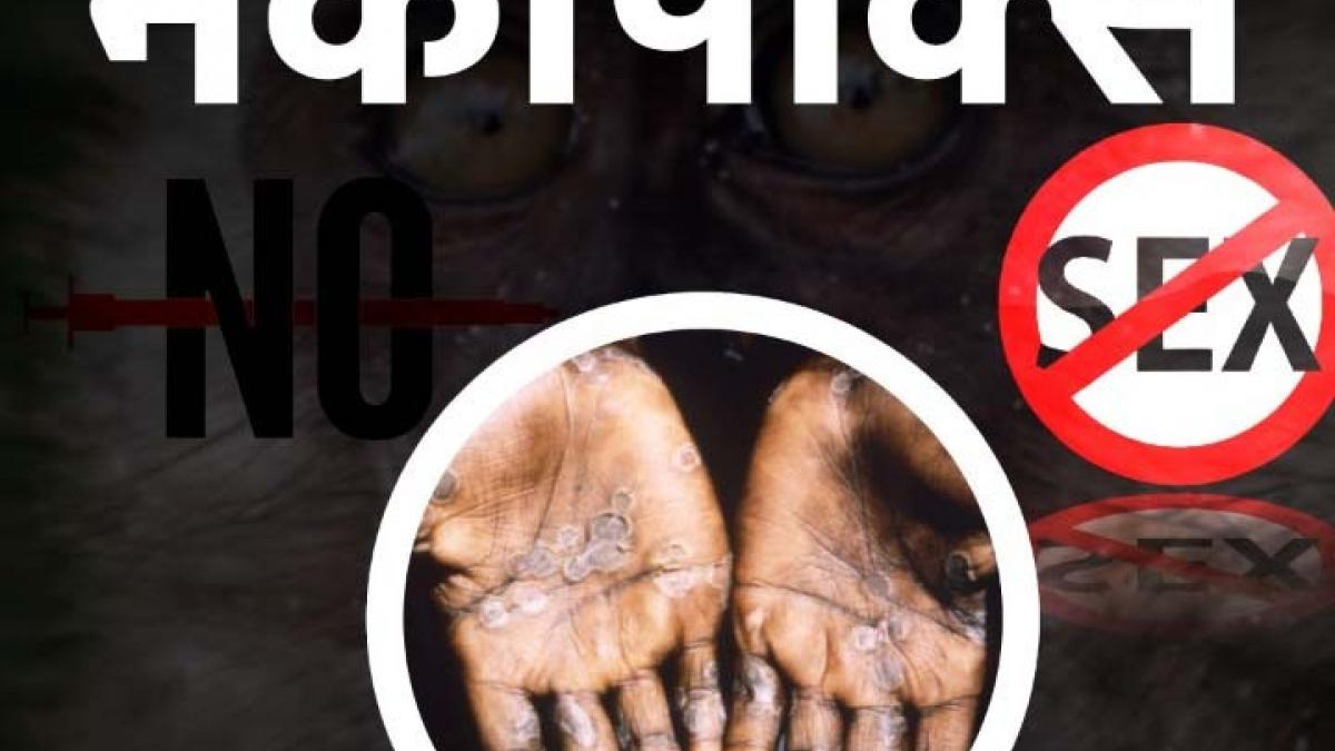 How to prevent Monkeypox