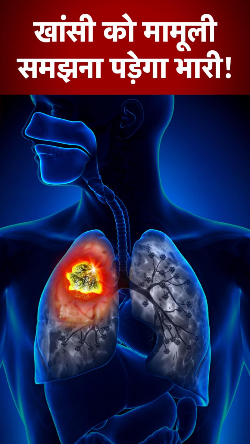 Chronic Cough: लंबी खासीं को मामूली समझना पड़ेगा भारी