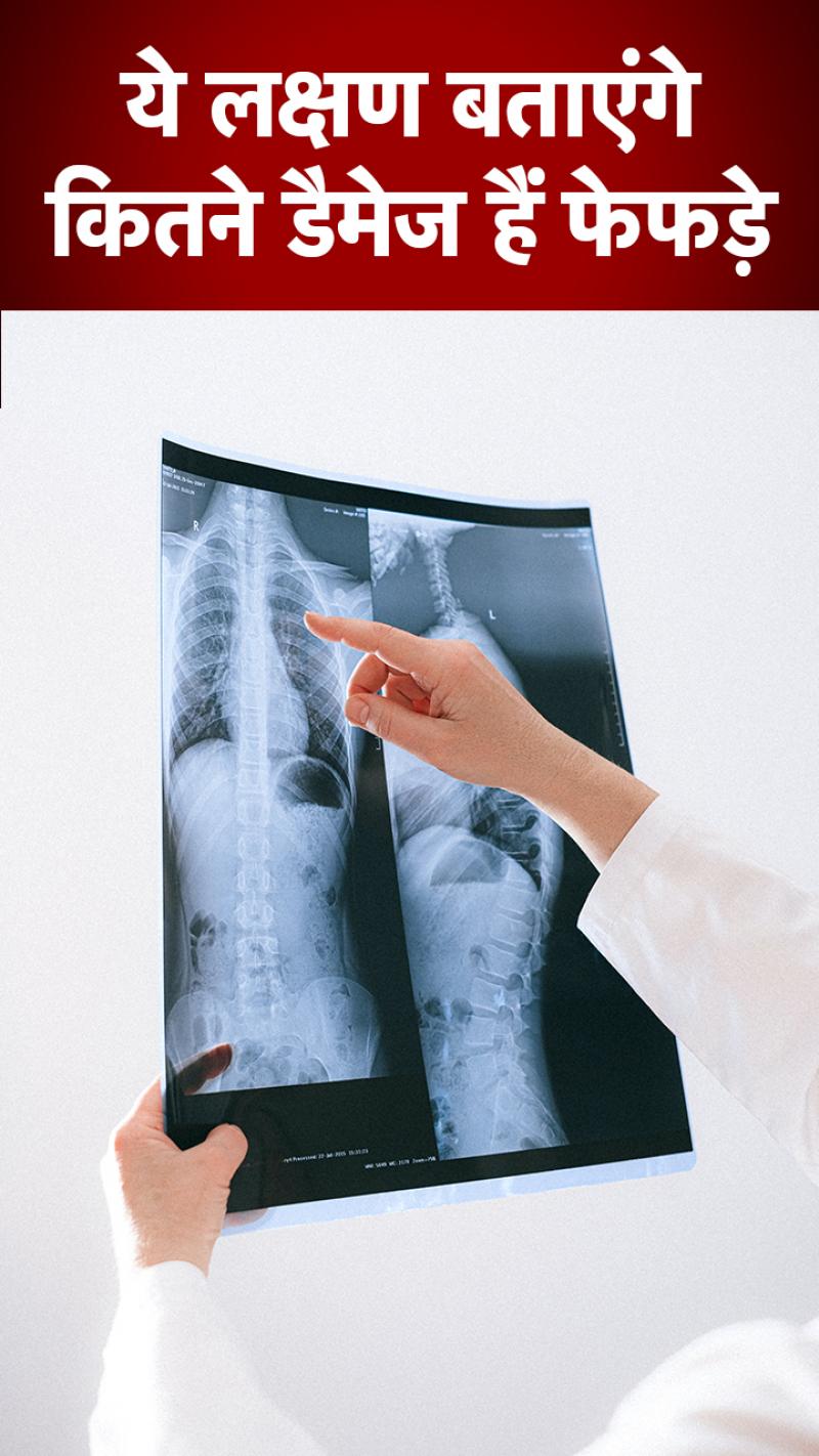 पेट दर्द हो सकता है खतरनाक, लापरवाही पड़ सकती है भारी