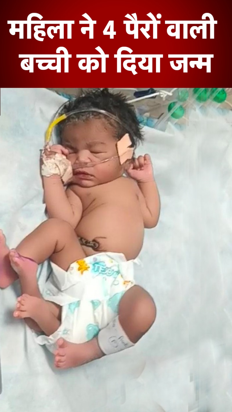 नवजात को देखने के लिए उमड़ी भीड़, डॉक्टर भी रह गए दंग