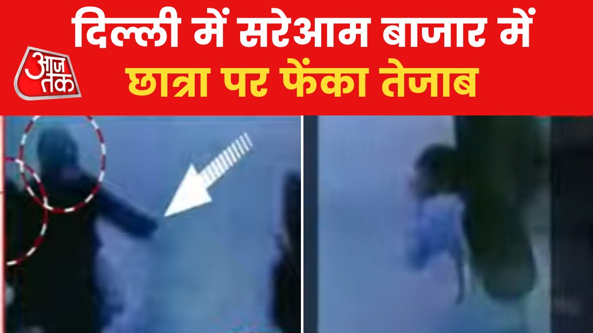 Delhi Girl Acid Attack: दिल्ली में स्कूली छात्रा पर लड़के ने फेंका एसिड, आरोपी को पुलिस ने किया अरेस्ट