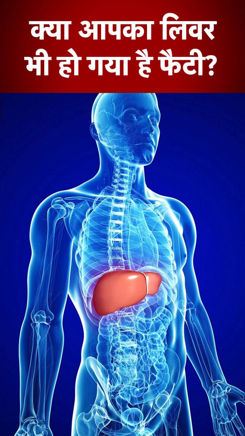 फैटी लिवर की समस्या से पाना चाहते हैं छुटकारा?
