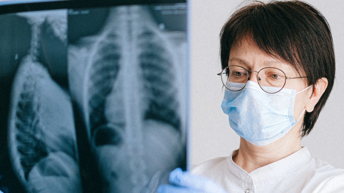 corona cause chest pain