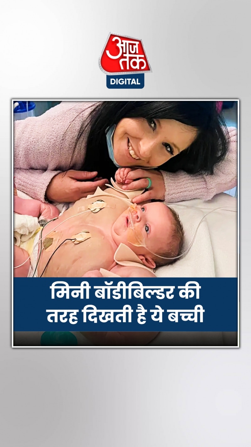 'मिनी हल्क' के नाम से फेमस है ये बच्ची