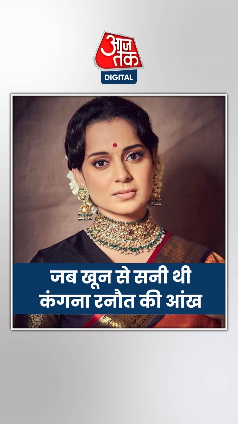 कंगना बोलीं- मणिकर्णिका के वक्त लगे थे 20 टांके