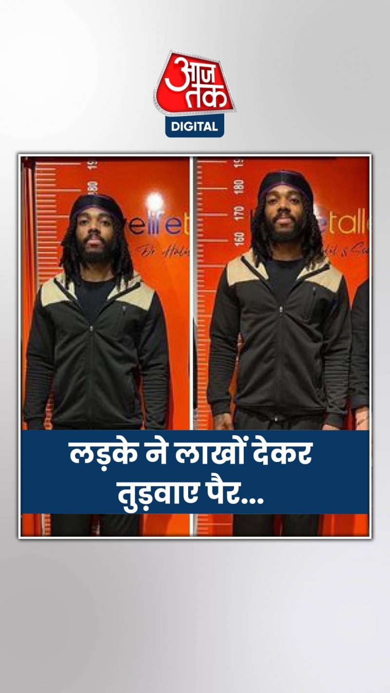 66 लाख खर्च कर ऐसे लंबा हुआ शख्स, शेयर किया VIDEO