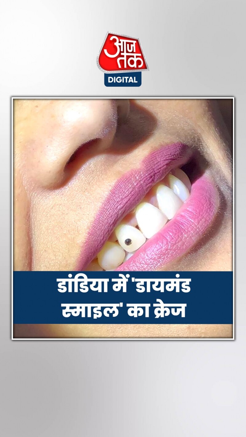 सूरत में दांतों में डायमंड क्यों लगवा रही हैं महिलाएं? देखें 