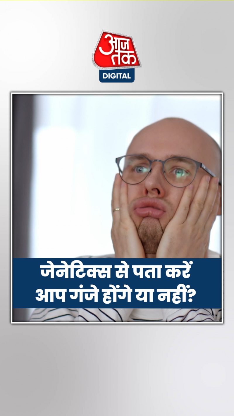 Baldness Genetics: क्या आपको भी होगा गंजापन, पापा-नाना को देखकर लग जाएगा पता