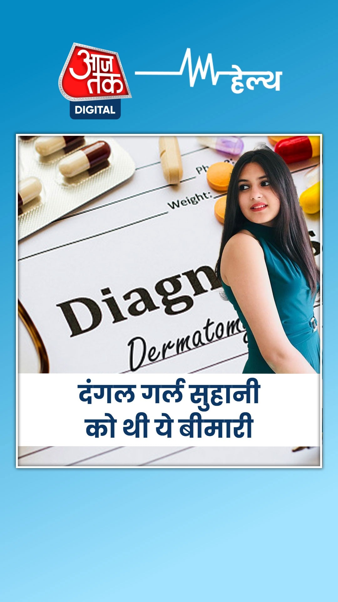 सूजन वाली ये बीमारी है क्या? जिसकी वजह से हुआ सुहानी का निधन