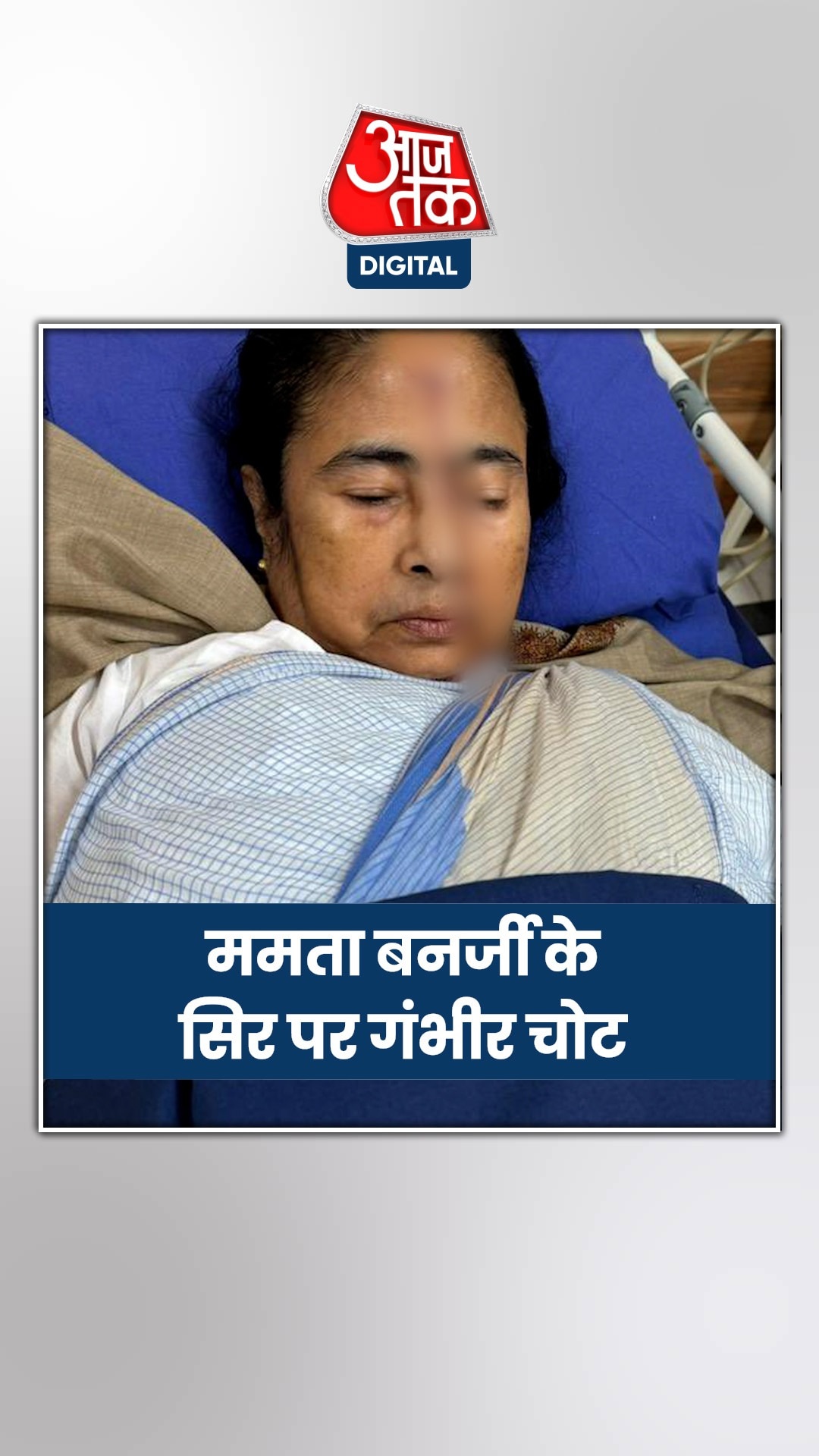 बंगाल सीएम ममता बनर्जी के सिर पर लगी गंभीर चोट