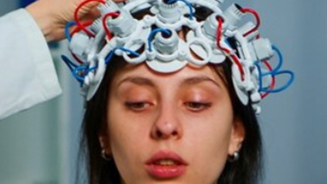 Guillain Barre Syndrome 