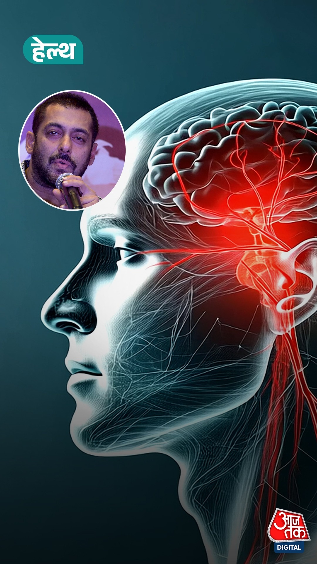 Salman को brain aneurysm, जानिए बीमारी क्या है और इलाज?