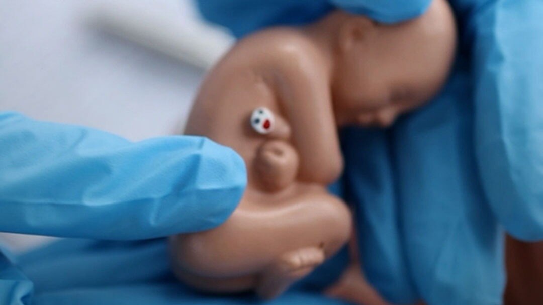 ivf invention who did and how in pregnancy