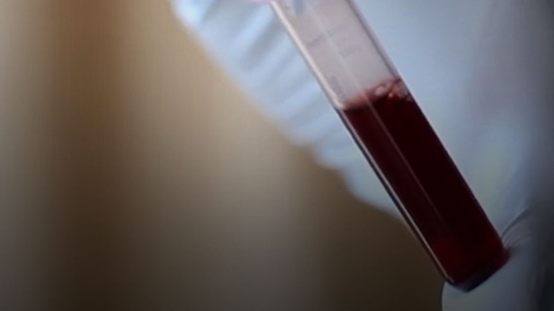 Blood Group