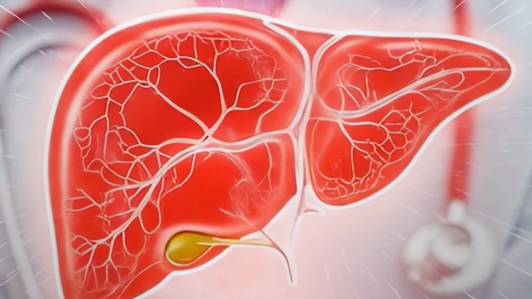 fatty liver infection in 84% people of IT sector