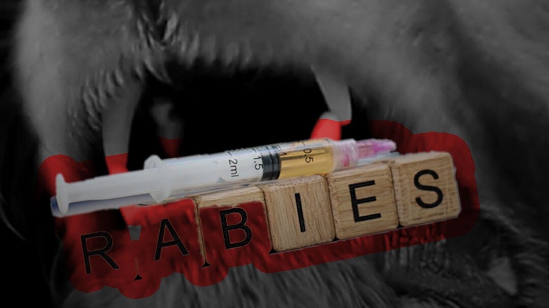 anti-rabies vaccination rule shared by doctor