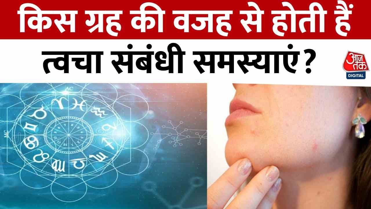 Bhagya Chakra: Skin problems? Learn which planets are responsible!