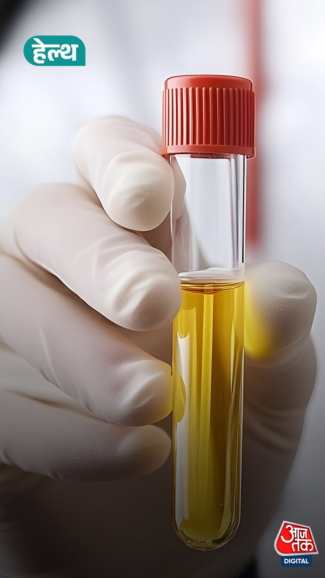 Urine Color Indications: पेशाब का रंग सेहत का आईना