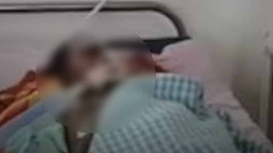 सूरत के सिविल अस्पताल में 'चमत्कार'