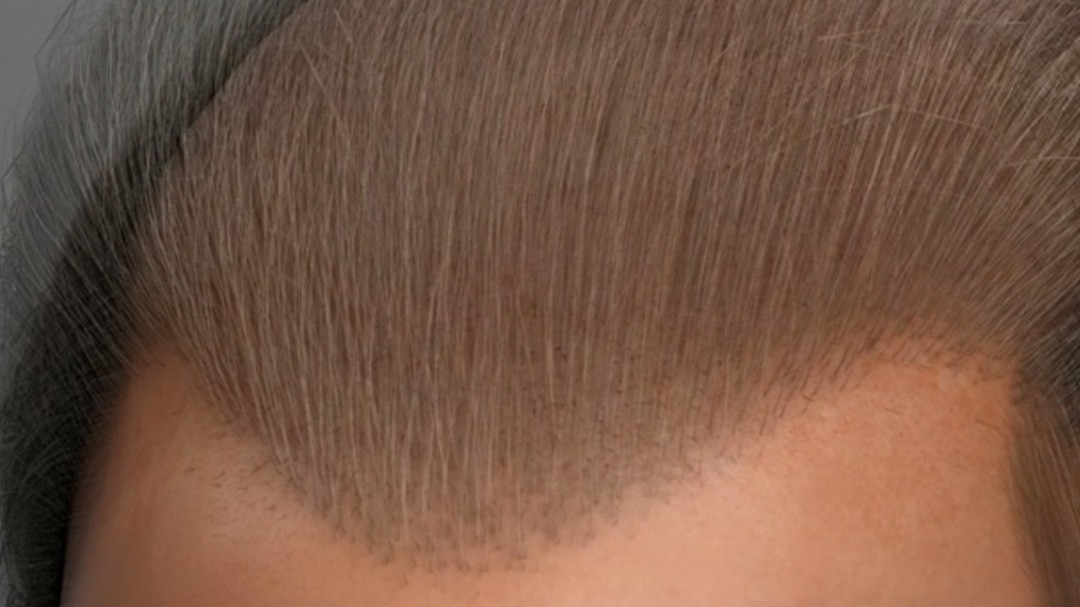 20 दिन में उगे बाल... Taiwan के वैज्ञानिकों का सीरम