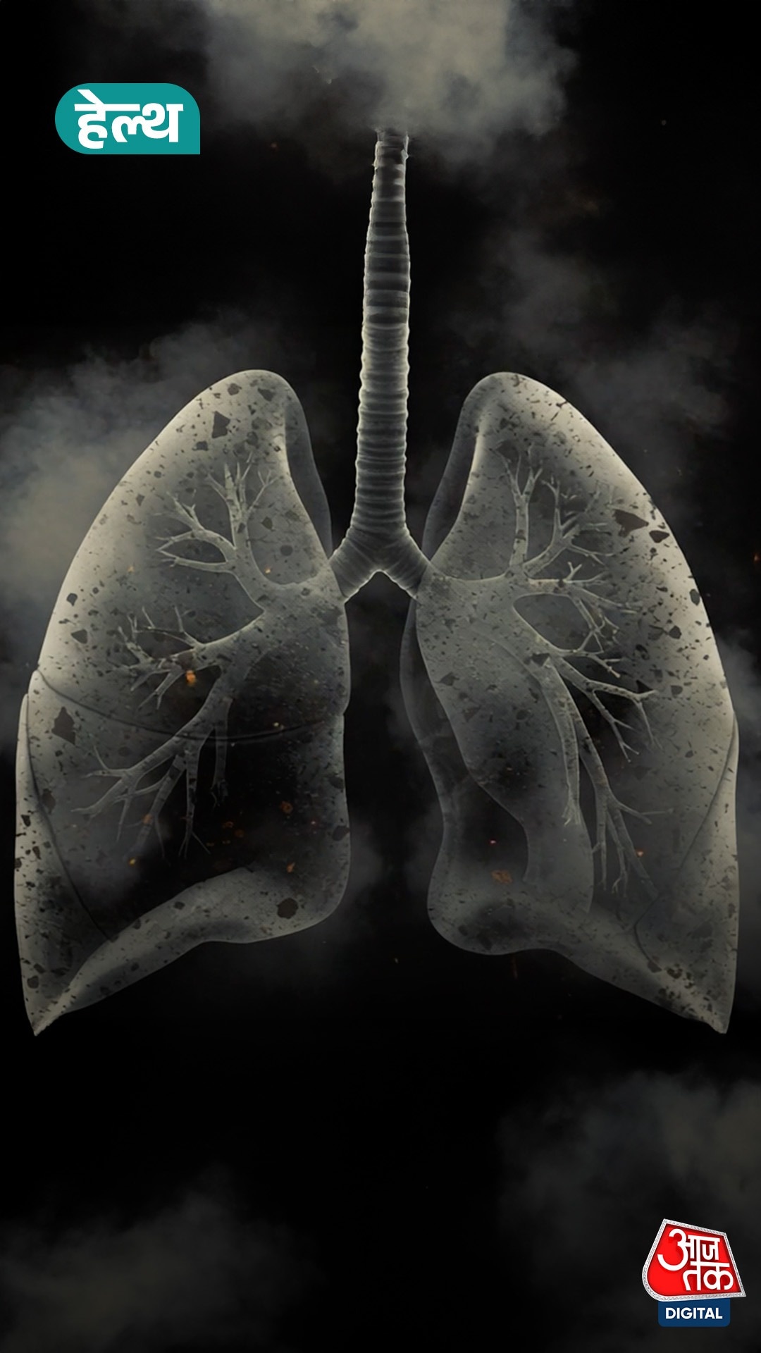 Chronic Obstructive Pulmonary Disease