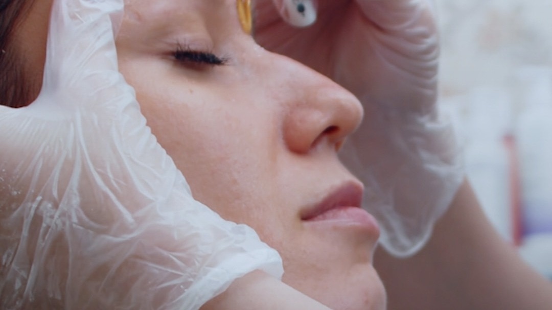 Girl facial hair problem