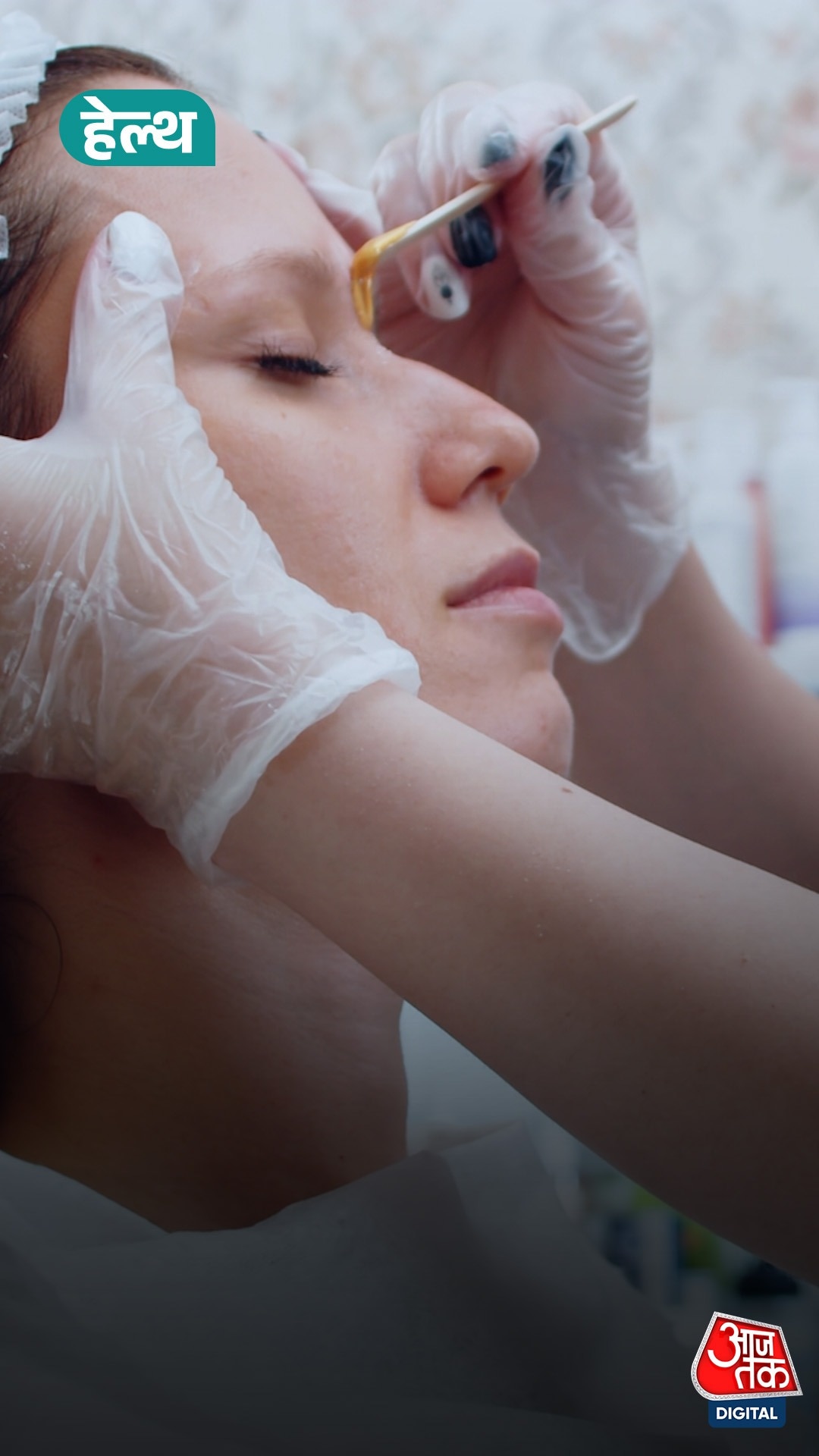 Girl facial hair problem