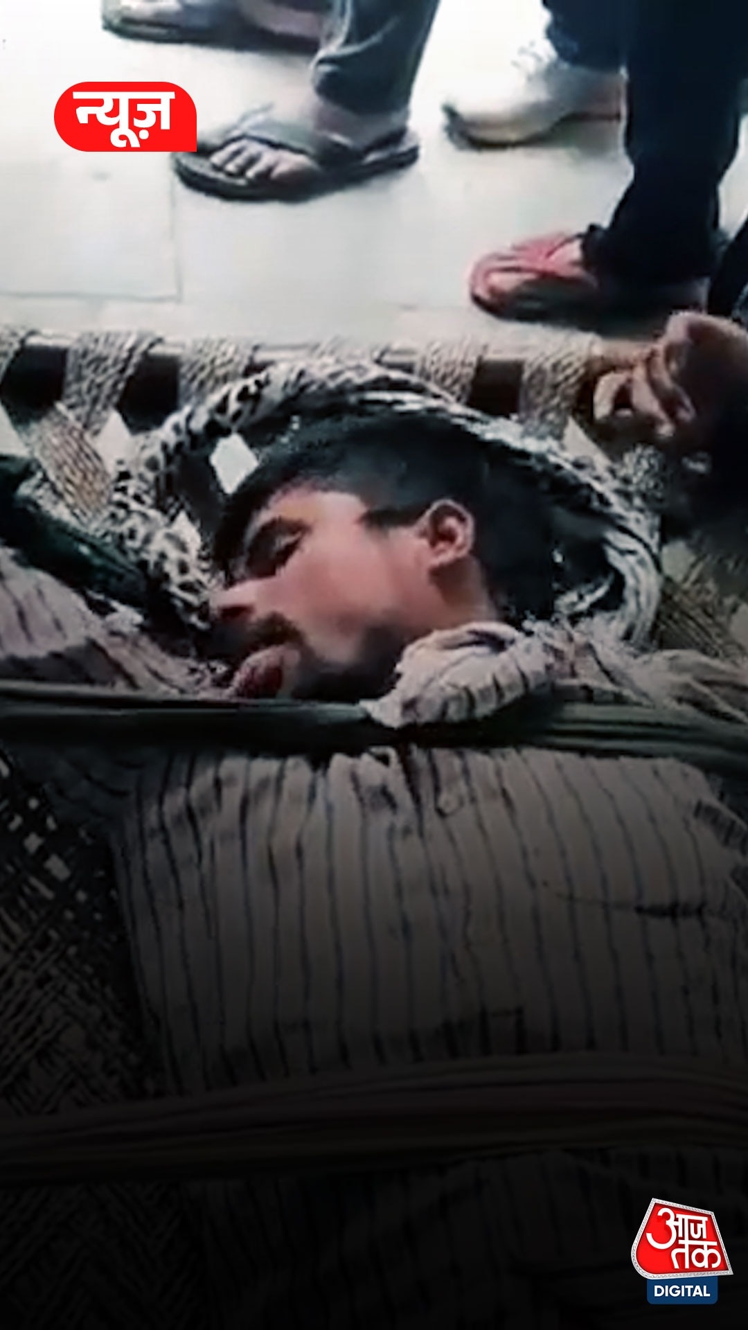 डॉग बाइट के बाद कुत्ते की तरह काटने दौड़ा युवक