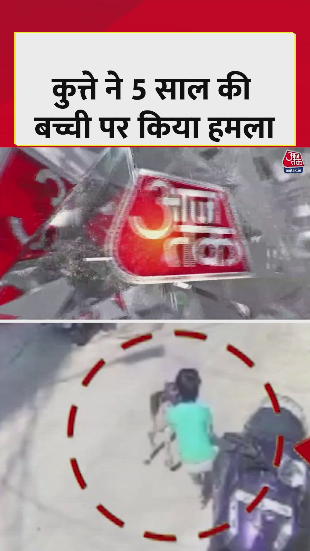 हैदराबाद में आवारा कुत्ते ने 5 साल की बच्ची पर किया हमला