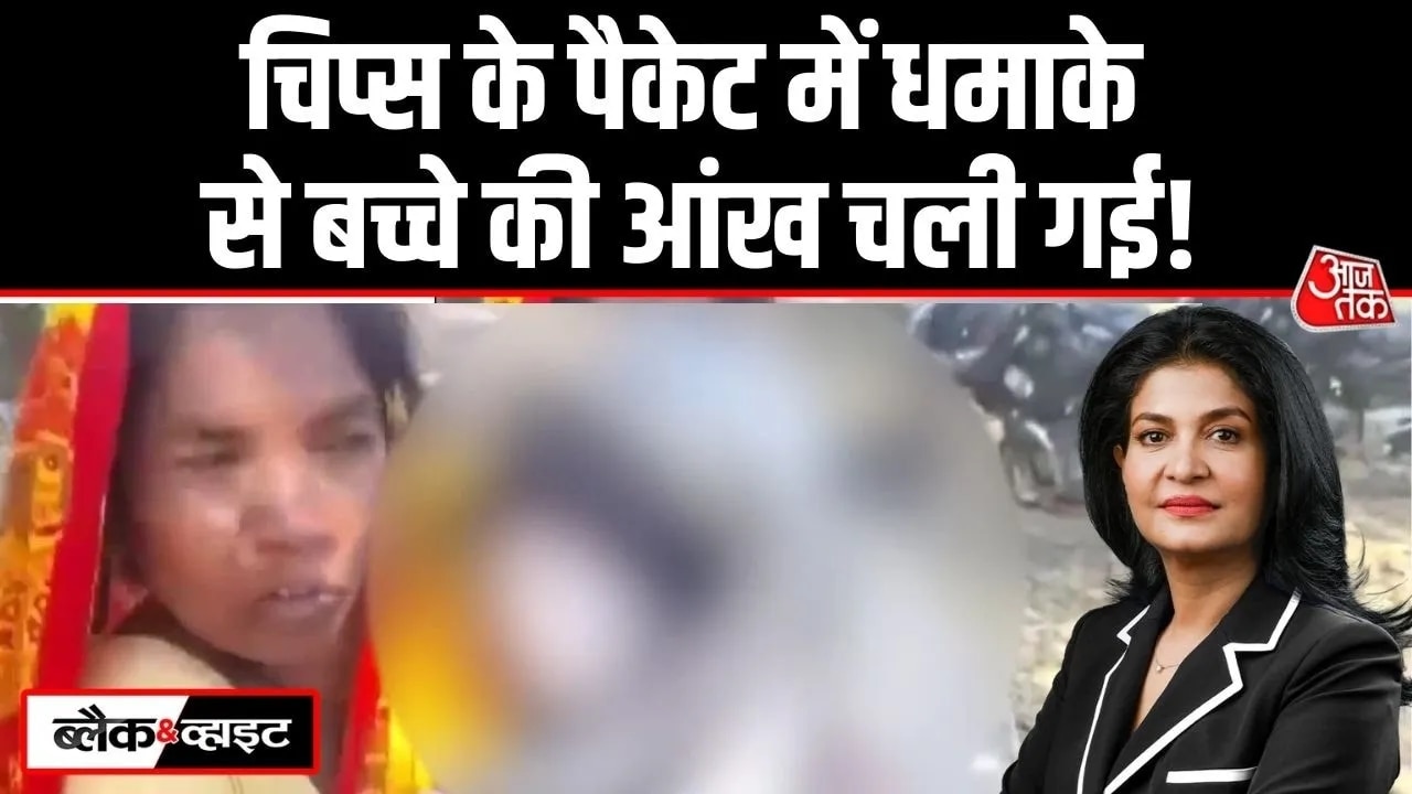 Boy in Odisha loses vision in one eye after chip packet bursts near gas stove