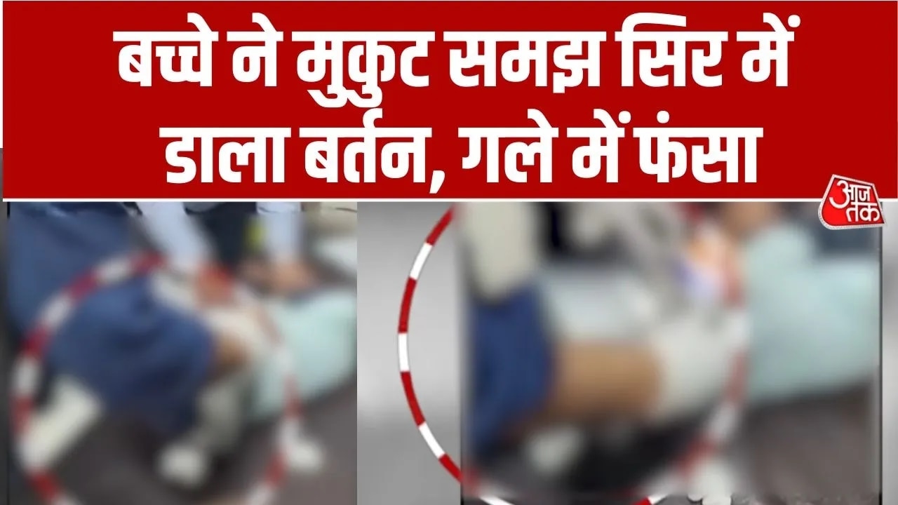 Three-year-old child stuck head in vessel in Jalgaon Maharashtra